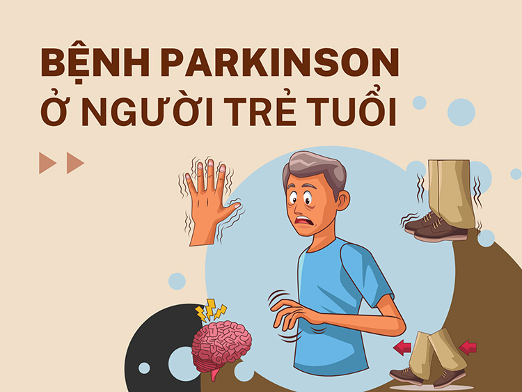 Tìm hiểu về bệnh Parkinson ở người trẻ tuổi